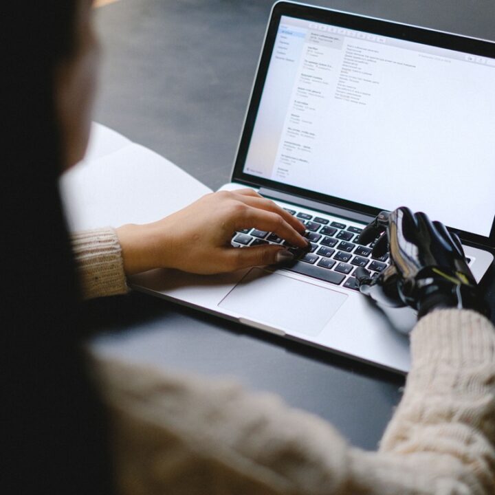 Person using a laptop with a prosthetic hand